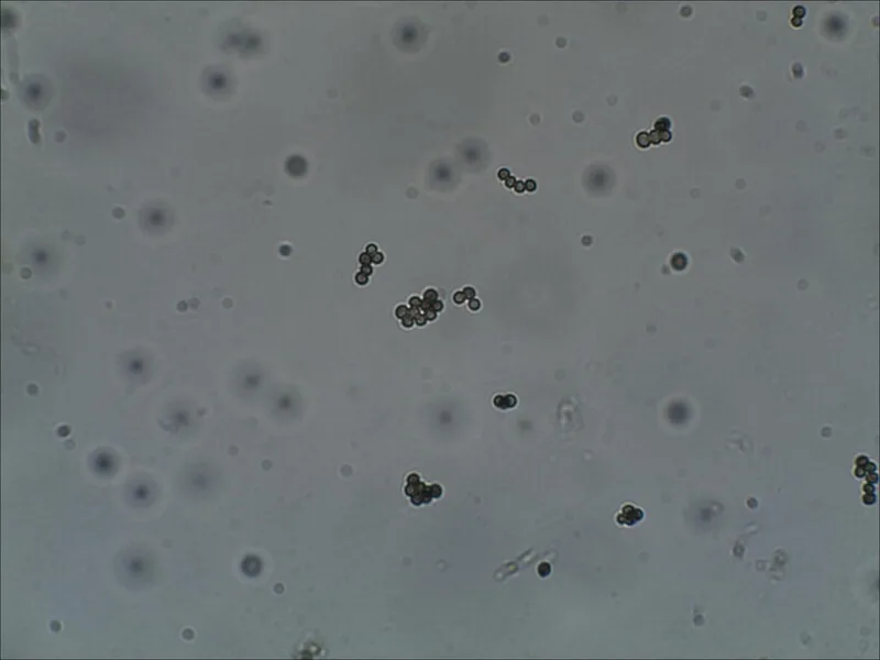 Конідії гриба Aspergillus niger під мікроскопом: діагностика цибулі