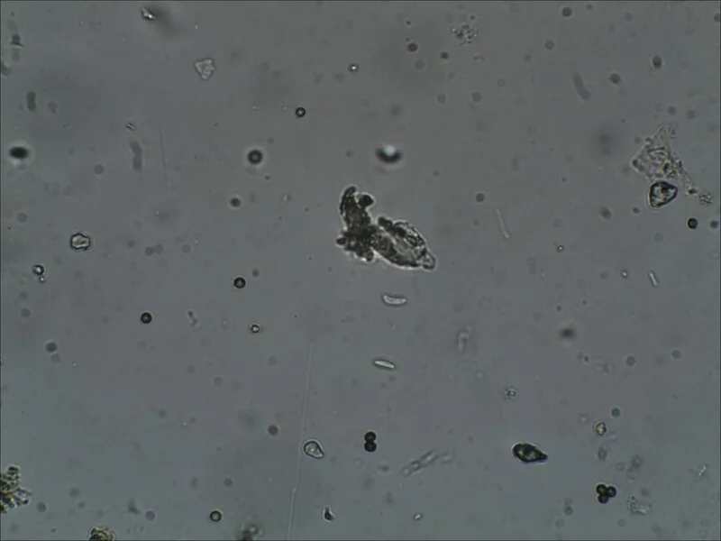Патоген Fusarium під мікроскопом: аналіз цибулі на зберіганні