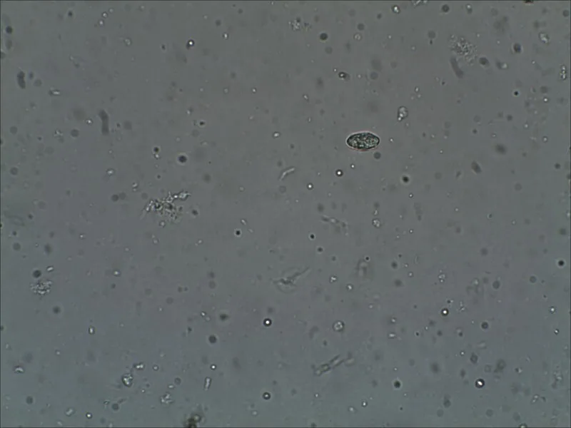 Спорангії Peronospora destructor під мікроскопом на залишках цибулі