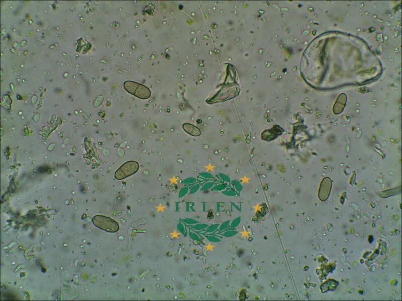 Пікніди Ascochyta на листку ріпаку під мікроскопом