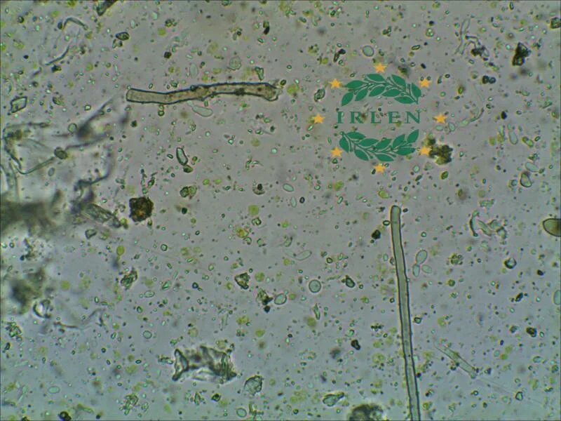 Міцелій гриба Fusarium у судинах ріпаку мікроскопія