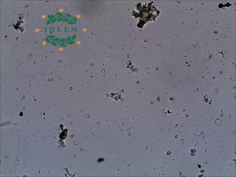 Мікроскопічне підтвердження фузаріозу (Fusarium) у корені часнику