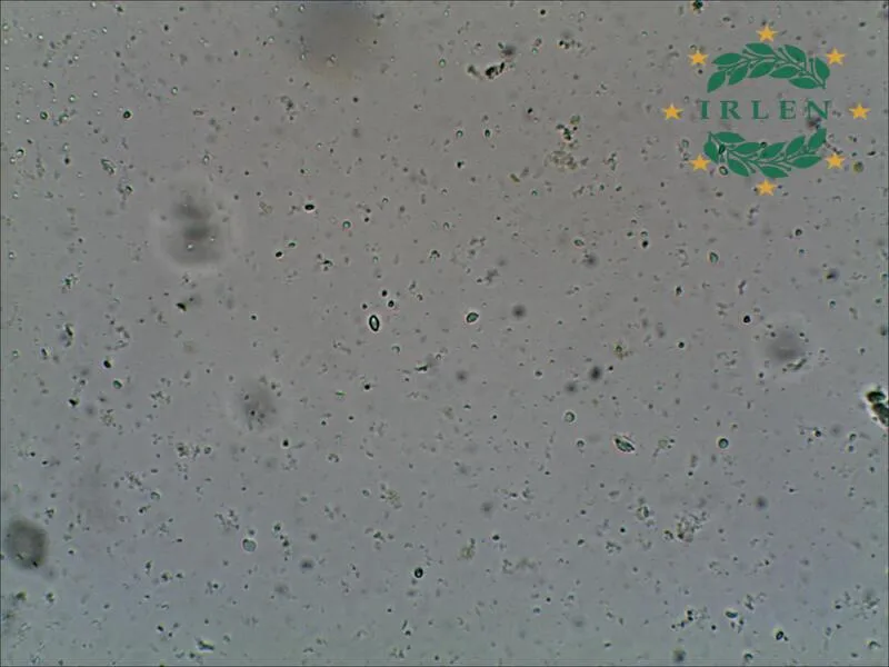Міцелій гриба Fusarium у тканинах кореня кавуна під мікроскопом
