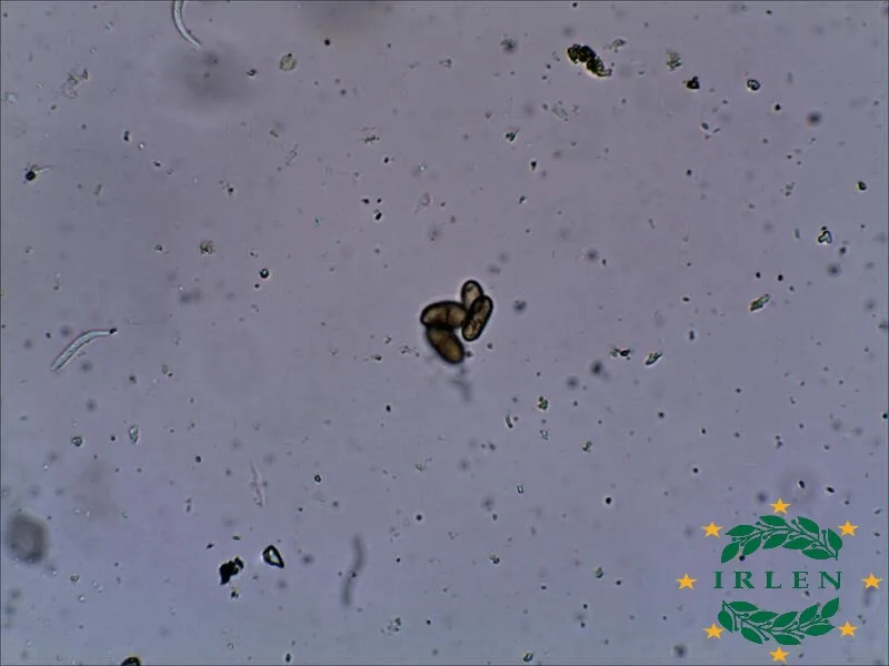 Грибні патогени Alternaria та Fusarium на листі горіха Фернор під мікроскопом